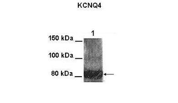 KCNQ4 Rabbit Polyclonal Antibody