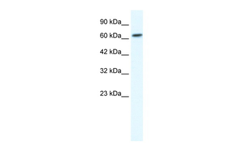GABRB2 Rabbit Polyclonal Antibody