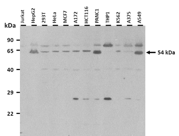 GABRB3 Rabbit Polyclonal Antibody