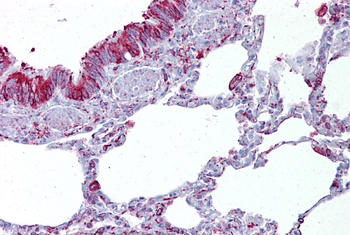 GABRB3 Rabbit Polyclonal Antibody