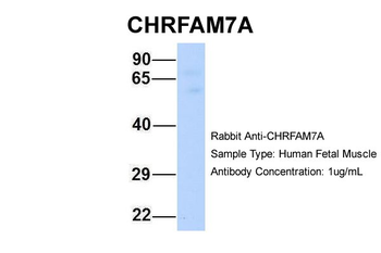 CHRFAM7A Rabbit Polyclonal Antibody