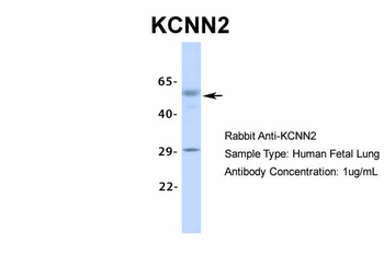 KCNN2 Rabbit Polyclonal Antibody