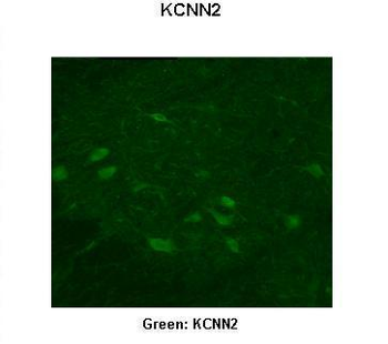 KCNN2 Rabbit Polyclonal Antibody