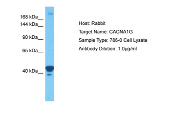 CACNA1G Rabbit Polyclonal Antibody