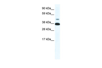 THRB Rabbit Polyclonal Antibody