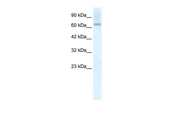 PIAS2 Rabbit Polyclonal Antibody