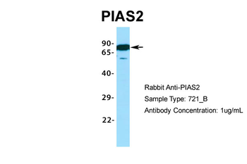 PIAS2 Rabbit Polyclonal Antibody