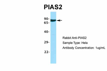 PIAS2 Rabbit Polyclonal Antibody