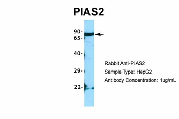 PIAS2 Rabbit Polyclonal Antibody