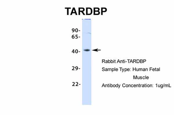 TARDBP Rabbit Polyclonal Antibody