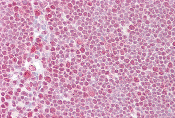 TARDBP Rabbit Polyclonal Antibody