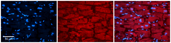 TARDBP Rabbit Polyclonal Antibody