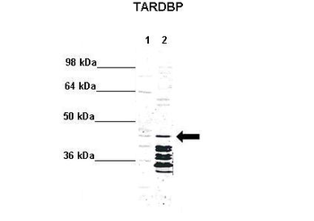 TARDBP Rabbit Polyclonal Antibody