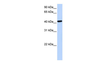 TARDBP Rabbit Polyclonal Antibody