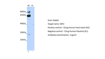 EBF2 Rabbit Polyclonal Antibody