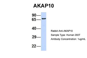 AKAP10 Rabbit Polyclonal Antibody