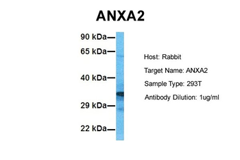 ANXA2 Rabbit Polyclonal Antibody