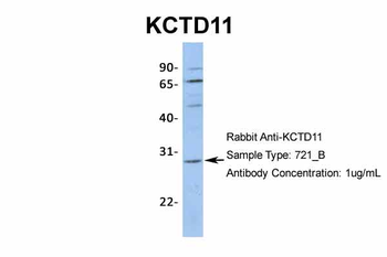 KCTD11 Rabbit Polyclonal Antibody