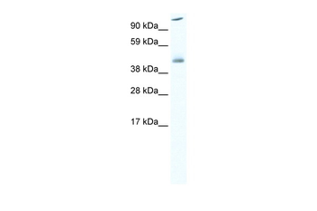 HSF1 Rabbit Polyclonal Antibody