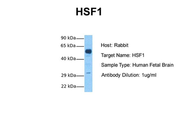HSF1 Rabbit Polyclonal Antibody