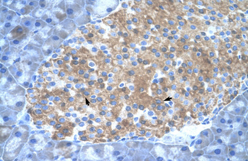 Pias2 Rabbit Polyclonal Antibody