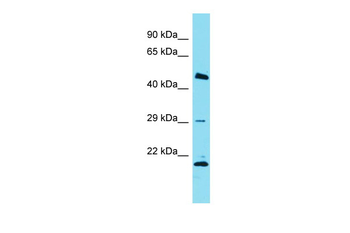 Relb Rabbit Polyclonal Antibody