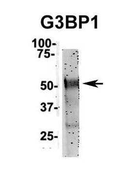 G3BP1 Rabbit Polyclonal Antibody