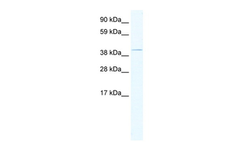 TAF7L Rabbit Polyclonal Antibody