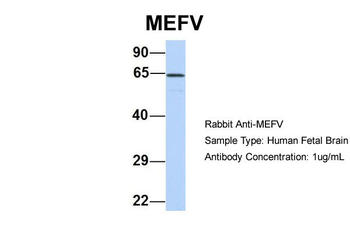 MEFV Rabbit Polyclonal Antibody