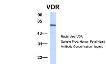 VDR Rabbit Polyclonal Antibody