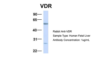 VDR Rabbit Polyclonal Antibody