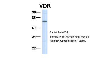 VDR Rabbit Polyclonal Antibody