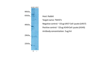 TWIST1 Rabbit Polyclonal Antibody