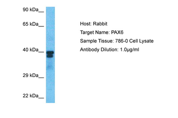 PAX6 Rabbit Polyclonal Antibody