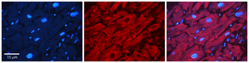 ATXN2 Rabbit Polyclonal Antibody