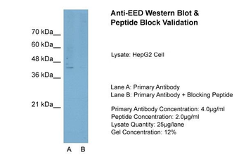 EED Rabbit Polyclonal Antibody
