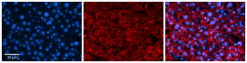 ZPR1 Rabbit Polyclonal Antibody