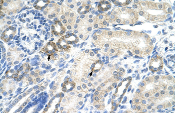 EZH2 Rabbit Polyclonal Antibody