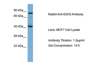 EZH2 Rabbit Polyclonal Antibody