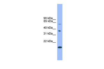 NOTCH4 Rabbit Polyclonal Antibody