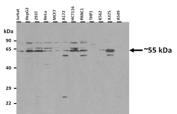 ETV1 Rabbit Polyclonal Antibody