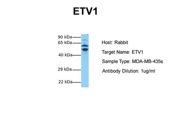 ETV1 Rabbit Polyclonal Antibody