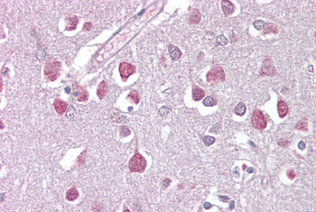 ETV1 Rabbit Polyclonal Antibody