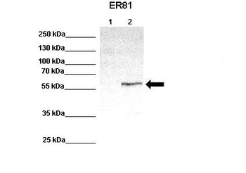 ETV1 Rabbit Polyclonal Antibody