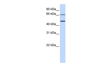 IRF6 Rabbit Polyclonal Antibody