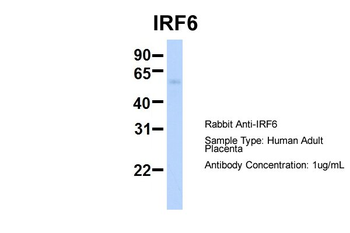 IRF6 Rabbit Polyclonal Antibody