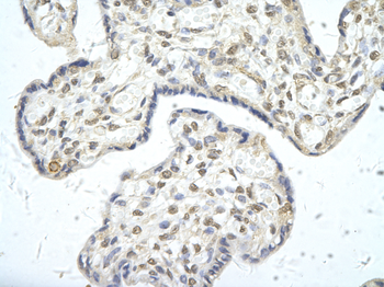 PPARD Rabbit Polyclonal Antibody