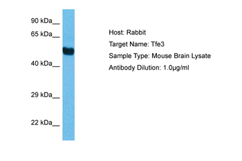 TFEB Rabbit Polyclonal Antibody
