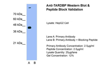 TARDBP Rabbit Polyclonal Antibody