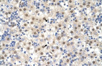 TARDBP Rabbit Polyclonal Antibody